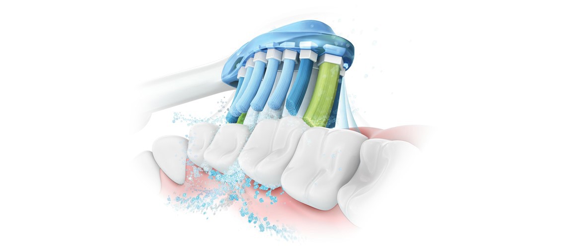 Sonična tehnologija slika